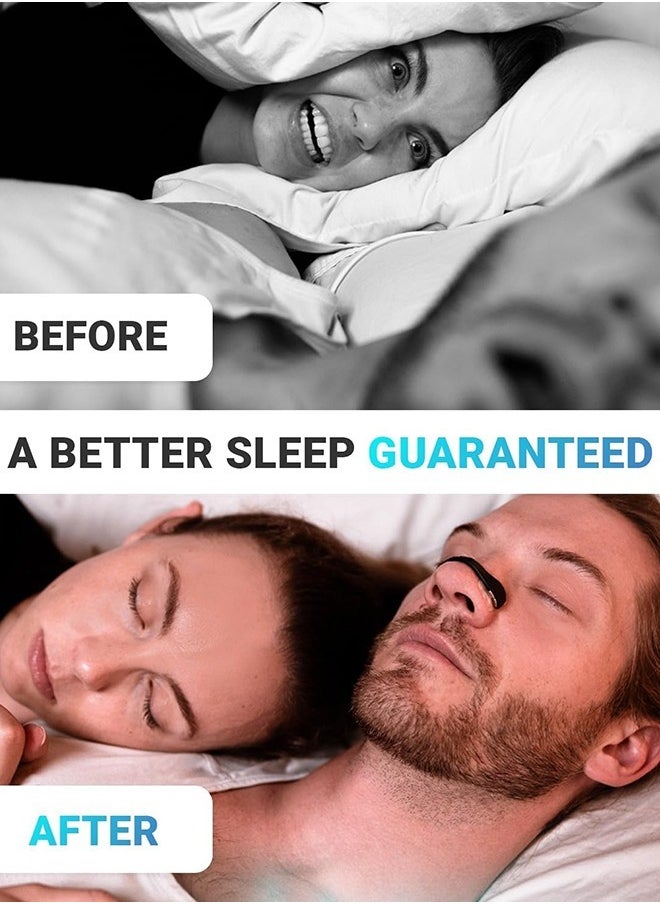 Eworld - Extra Strength Nasal Strips Kit with Magnetic Dilator for Enhanced Sleep, Reduces Snoring and Boosts Oxygen Intake, Skin-Safe Snoring Solution with Applicator, 4 Reusable Bands and 30 Tabs - Image 1