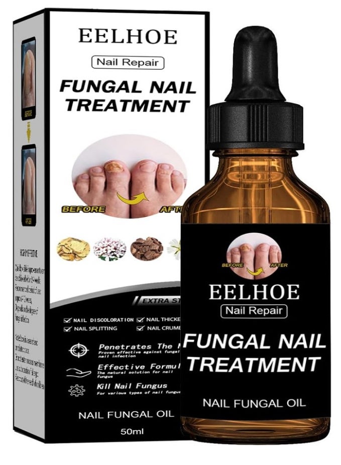 EELHOE Toenail Fungus Treatment Extra Strength – Nail Fungal Oil with Glycerin & Panthenol, 4 Pure Natural Plant Extracts, Fung Damaged Nails, Discoloration Nails, Nail Psoriasis, Nails Aging, 50ml - Image 1