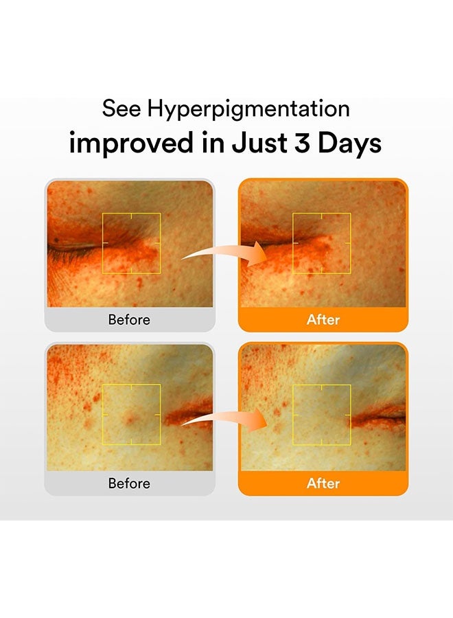 ابيب Glutathiosome Dark Spot Serum 50ml, Dark Spot, علاج التصبغ الزائد بنياسيناميد, فياتمين سي, مصل إضاءة للبشرة الحساسة وغير المتساوية - Image 2