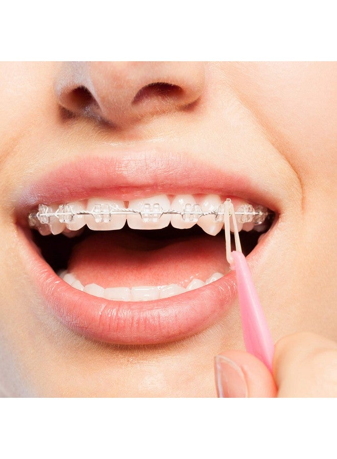 JMU أشرطة مطاطية تقويمية للأسنان مقاس 316 بوصة ثقيلة 6.5 أونصة عبوة من 100 شريط مطاطي داخل الفم شرائط مطاطية خالية من اللاتكس مصنوعة في الولايات المتحدة الأمريكية - Image 2