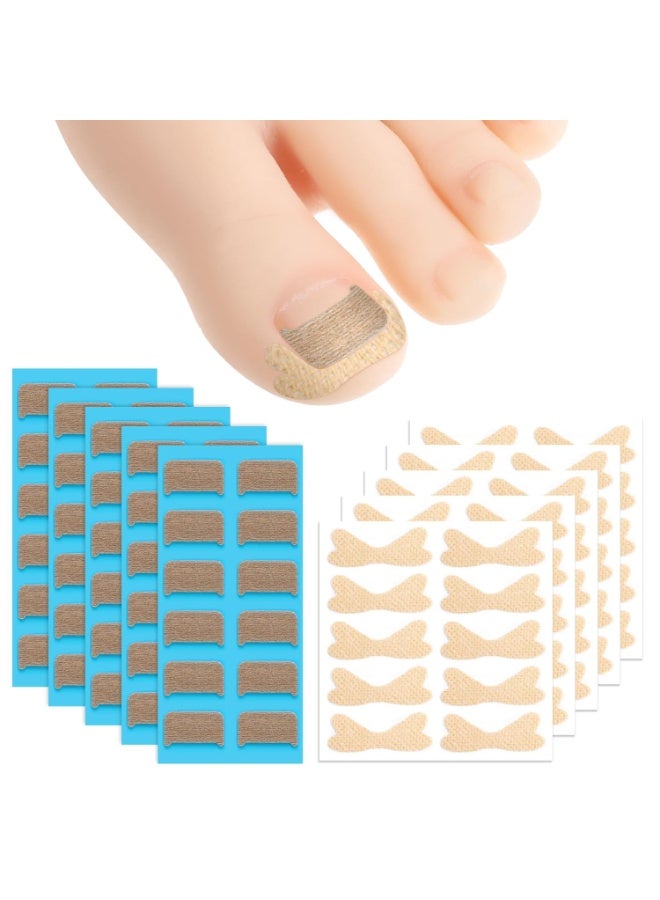 general 60pcs Ingrown Toenail Corrector Patch and 50pcs Ingrown Toenail Strips Breathable Ingrowns Toenails Stickers Ingrowns Toenails Tape for at Home Ingrown Toenail Treatment Pain Relief and Correction - Image 1