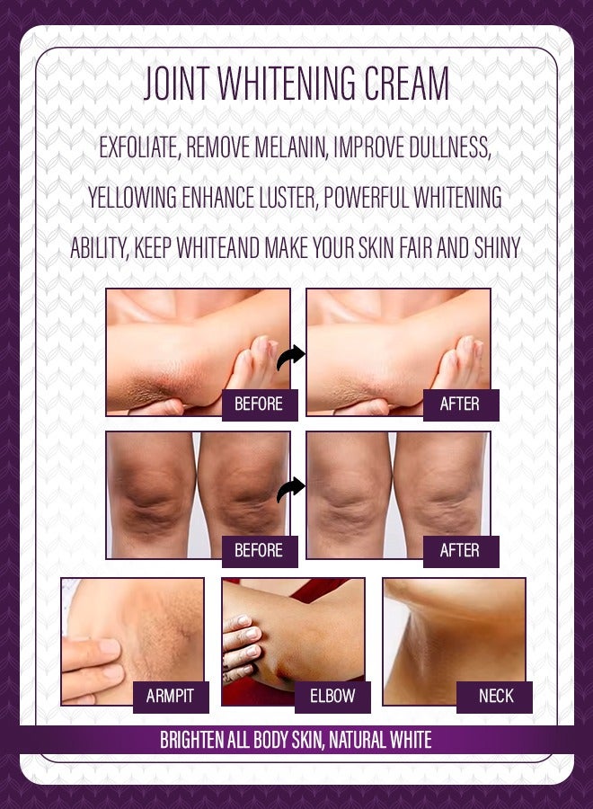 Kanza كريم تبييض الركب والمرفقين 120 جرام - تبييض الإبطين والبقع الداكنة - تخلص من الكوعين بسهولة في 7 أيام - تبييض قوي للبشرة للنساء والرجال - Image 5