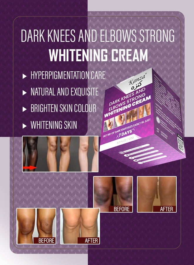 Kanza كريم تبييض الركب والمرفقين 120 جرام - تبييض الإبطين والبقع الداكنة - تخلص من الكوعين بسهولة في 7 أيام - تبييض قوي للبشرة للنساء والرجال - Image 4