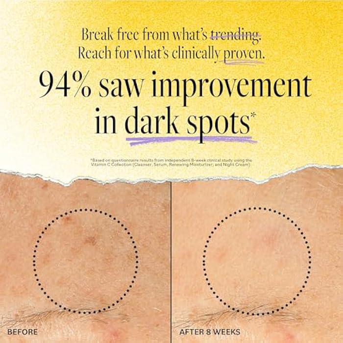 DERMA-E Vitamin C Intense Night Cream, 2 Oz, Brightening and Hydrating Facial Skin Renewing Cream, Anti-Aging Overnight Face Moisturizer for Skincare and Youthful Radiance - Image 3