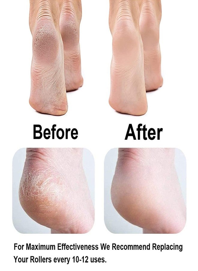 Flawless Pedi Electronic Pedicure Tool Cordless Rechargeable Callus Dead Skin Remover Polishing Wand with Roller Heads Flawless Pedi Electronic Pedicure Tool Callus Dead Skin Remover - Image 5