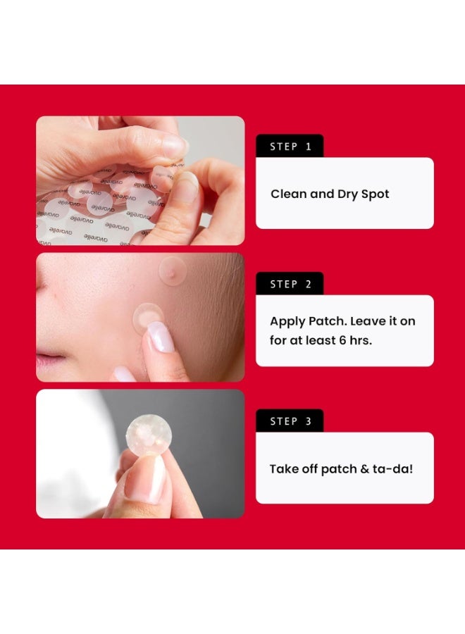 AVARELLE Avarelle Acne Pimple Patch (40 Count) Absorbing Hydrocolloid Spot Treatment with Tea Tree Oil, Calendula Oil and Cica, Certified Vegan, Cruelty Free (VARIETY / 40 COUNT)  - Image 3