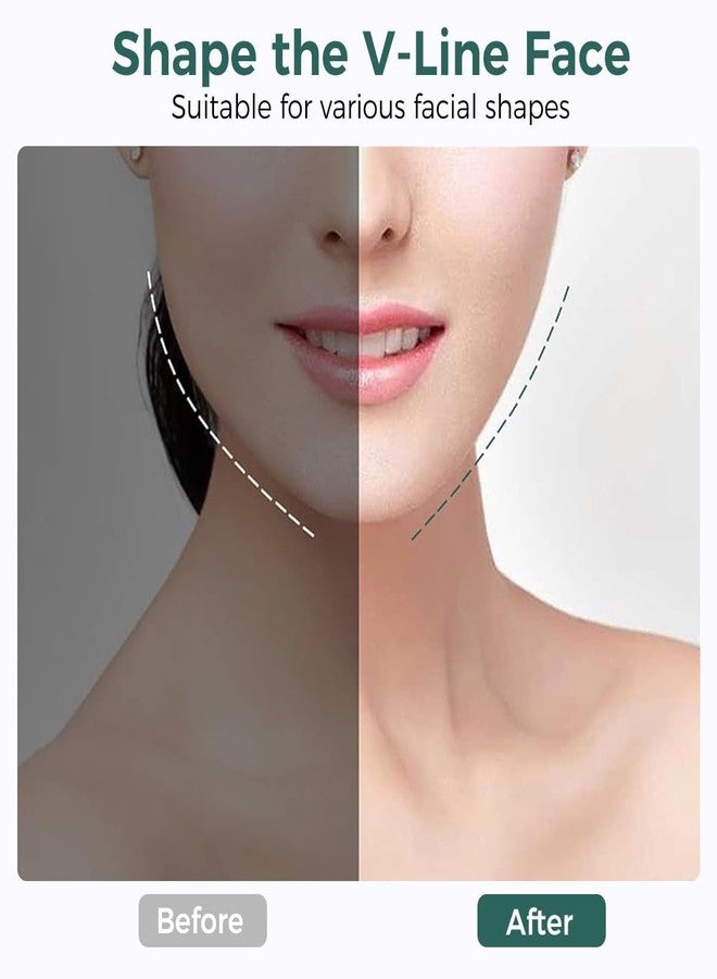 BIRDLINE V-Shape Face Slimming Belt | Double Chin Shaper for Men and Women | Facial Lift Mask for Slimming Cheeks, Anti-Wrinkle Chin Strap, Reusable Nylon Face Slimming Bandage (Multicolor) - Image 3