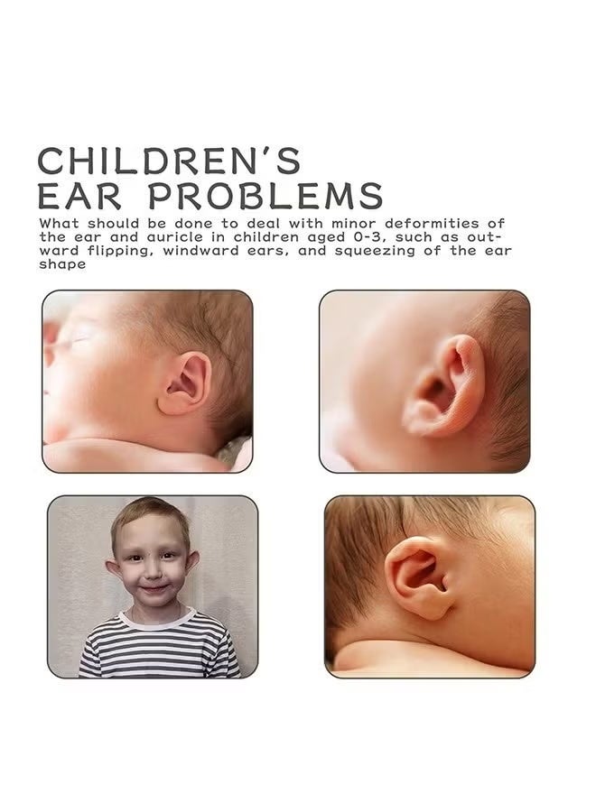 wiieey 1 Pcs Baby Auricle Valgus Patch Ear Aesthetic Correctors Silicone Gel Ear Corrector Tape Waterproof Kids Protruding Ear Patch Stickers Baby Ear Aesthetic Fixation Patch 4x150cm - Image 4