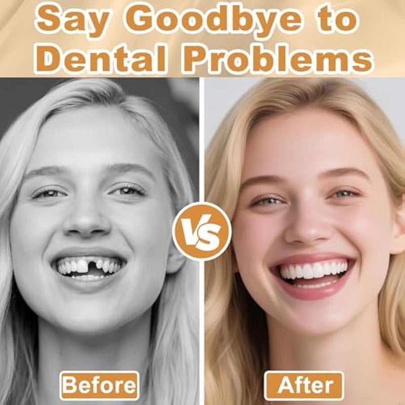 Arabest Moldable False Teeth, Veneers Teeth for Women and Men, Upper and Lower Matching Set Tooth Repair Kit, Fix Your Smile at Home Within Minutes, 1PCS-Q - Image 3