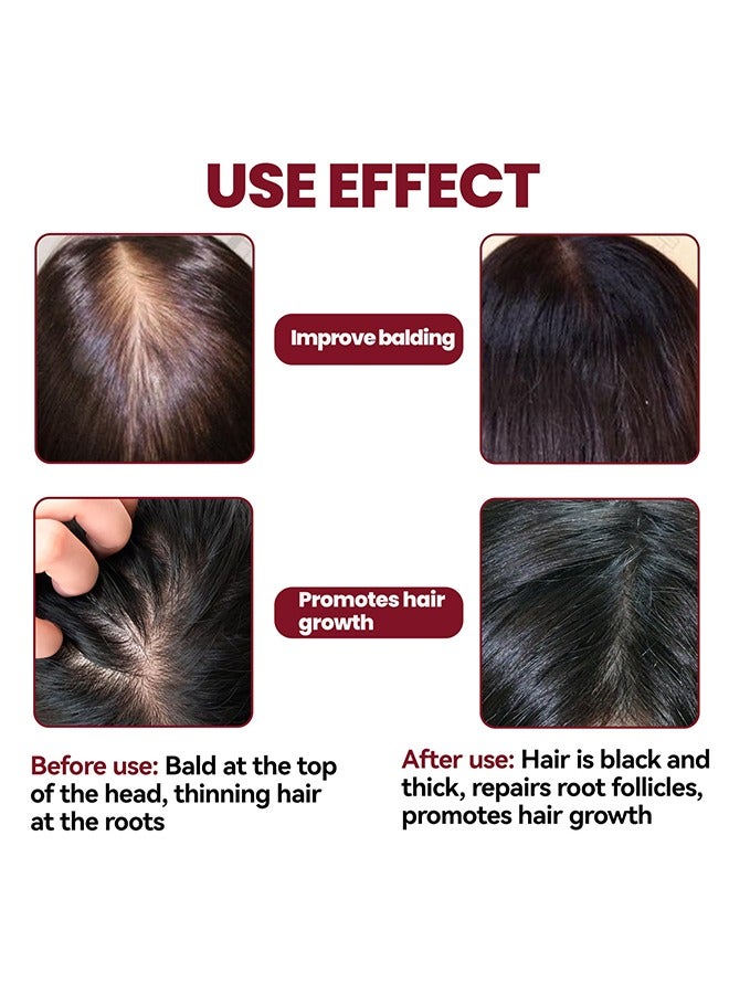 EELHOE Hair regeneration foam，revivies and restores hair follicles，for women hair health care four month supply 60g - Image 3