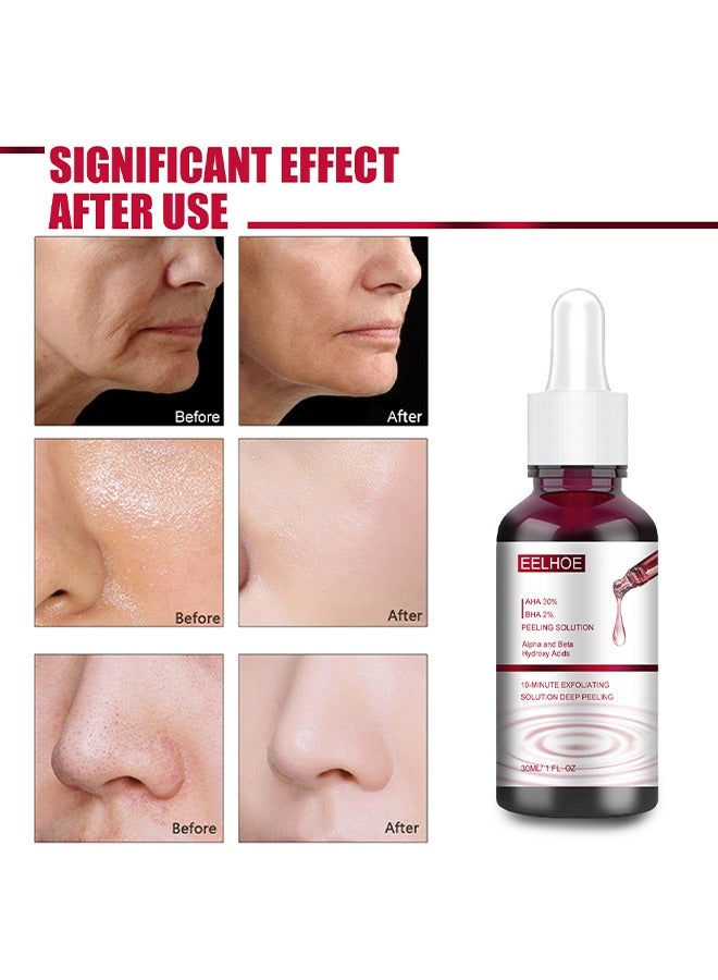 إيلهو AHA30٪ + BHA محلول تقشير 2٪ ، خلاصة حمض الساليسيليك ، إصلاح ترطيب النغمة ، تقشير قوي ومسام كليم عميقة ، 30 مل - Image 3