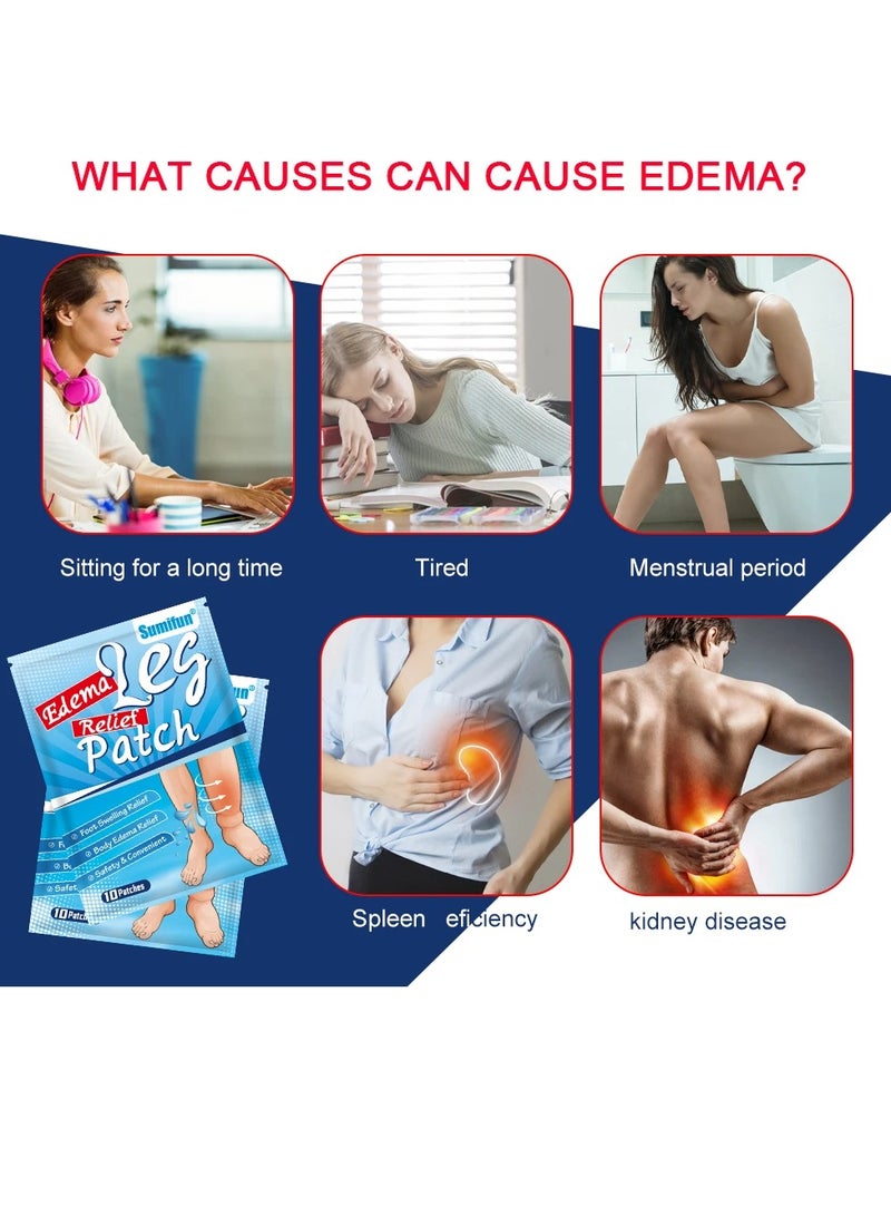 Sumifun Edema Swelling Removal Plaster, non irritating smooth Leg Edema Relief Patches, Pain Relief  Arm Thigh Dropsy Massage Medical plaster to Reduce Swelling and  Discomfort, (10 patches)  - Image 5