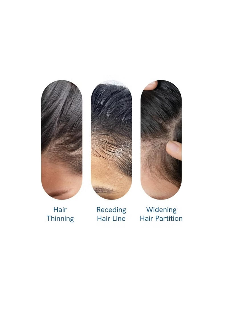 Be Bodywise 3% Redensyl & Rosemary Hair Growth Serum (Roll On) | Pack of 1 | 2% Anagain | Thicker & Stronger Hair | Prevents Hairfall & Stimulates Hair Follicles | For All Hair Types | 25 ml - Image 3