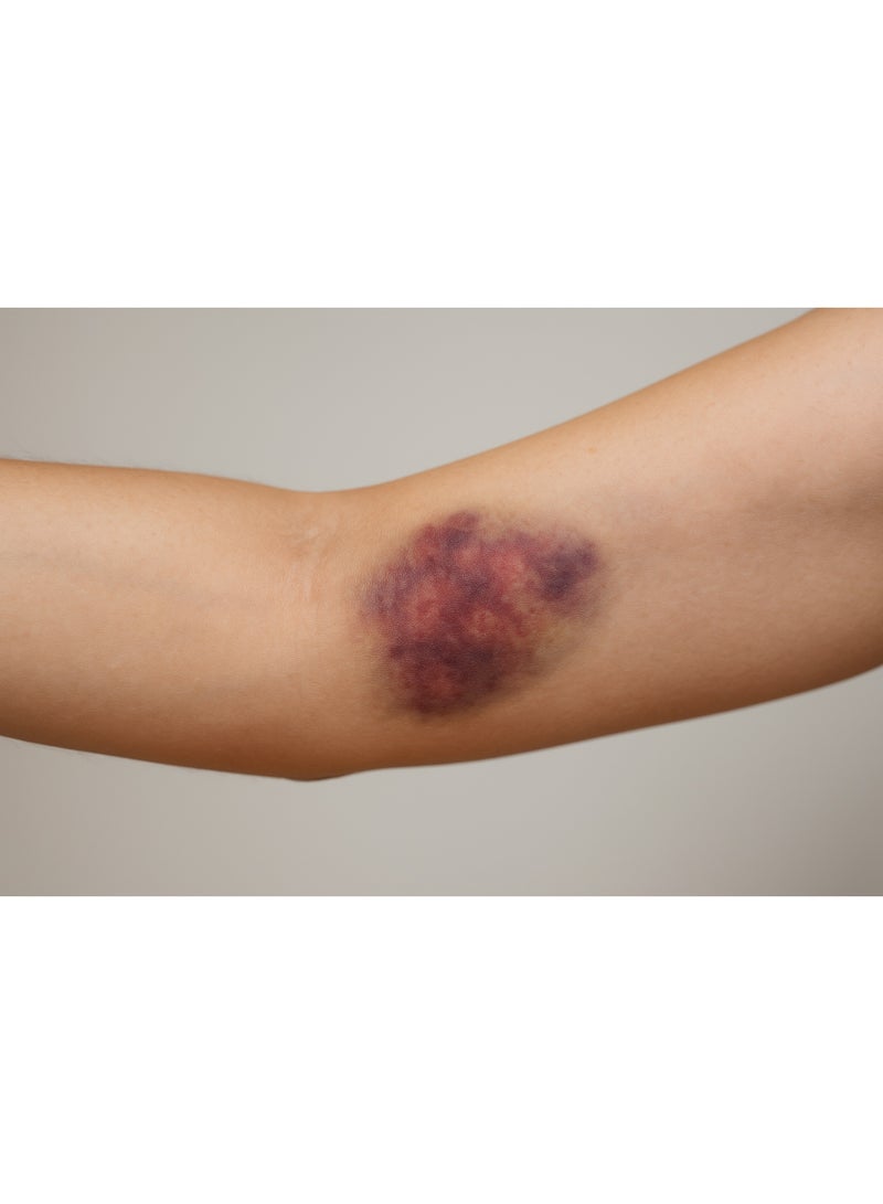 ريباريل أقراص - لتخفيف الالتهاب والوذمة والتورم - دعم التعافي من الألم والكدمات - 40 قرصًا - Image 3