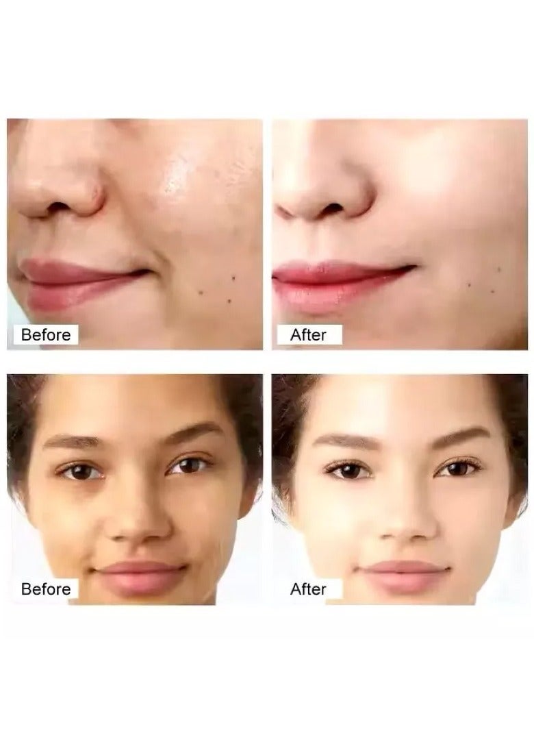 VTERLY BL Vterly Day And Night Dark Spot Removal Lightening Whitening Brightening Face Cream - Image 4