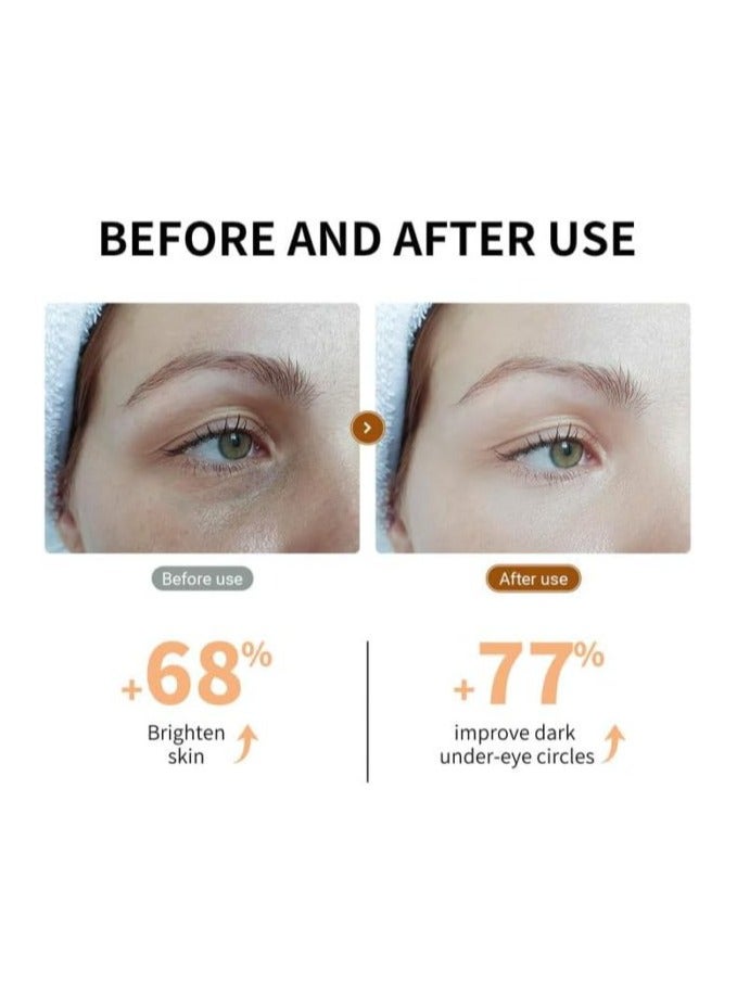 LANBENA Lanbena Vitamin C Hydra Gel Eye Patch 30 Pairs, Vitamin C Serum Brightening Skin 15ML 2 Pcs Set - Image 5