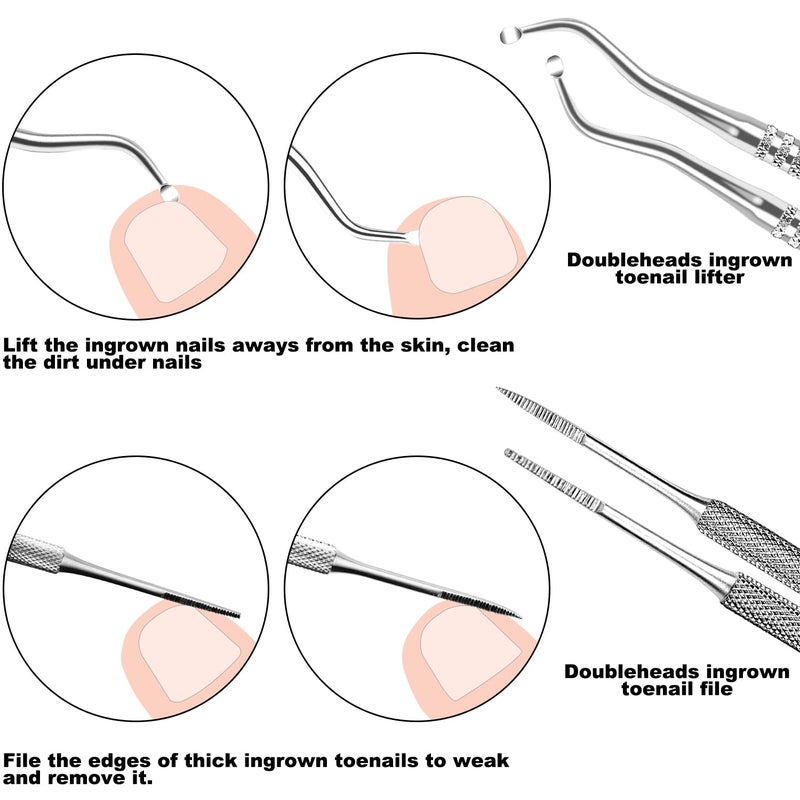 ZIZZON 7 Pcs Ingrown Toenail File and Lifters Set, Stainless Steel Ingrown Toenail Removal Kit, Under Nail Cleaner Pedicure Tools - Image 4