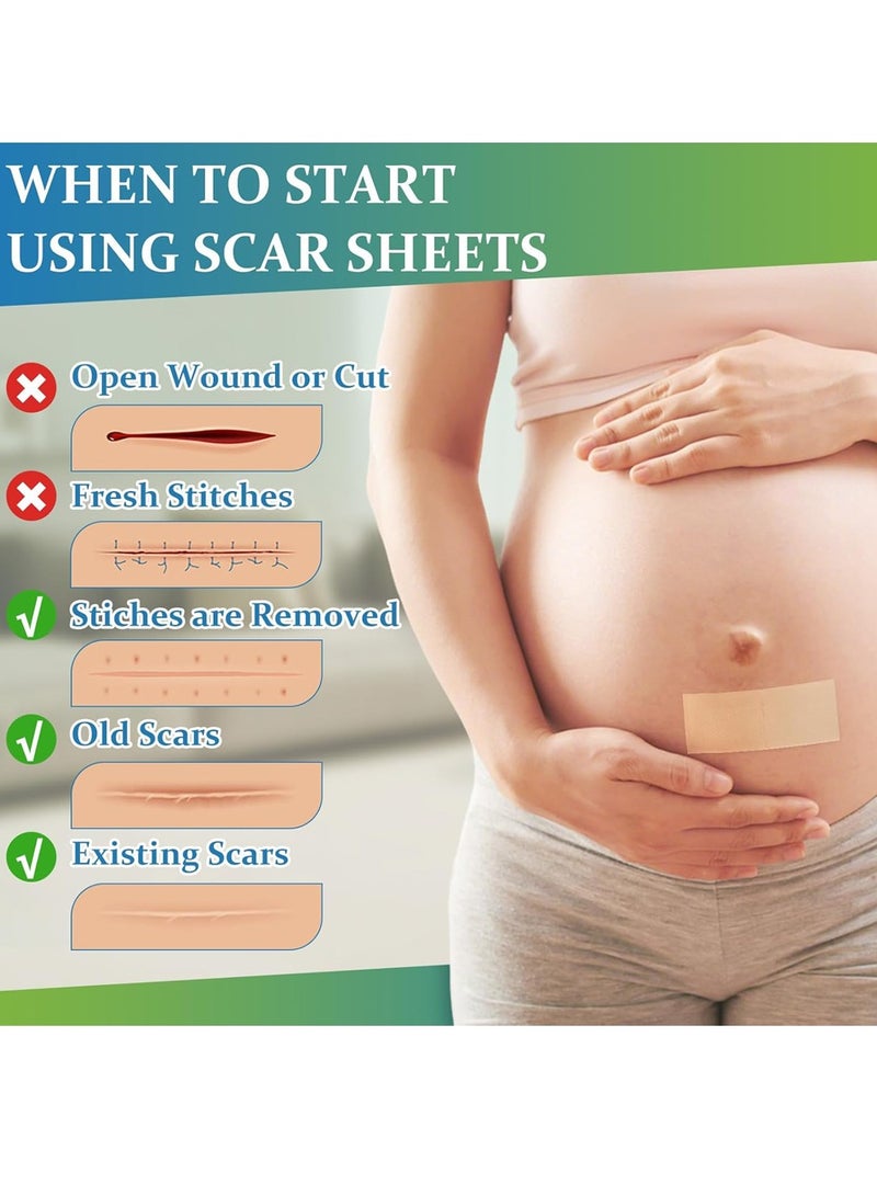 Generic Silicone Scar Sheets, Medical Grade Silicone Scar Tape, Reusable Removal Improve Strips for Surgical C-Section, Keloid, Tummy Tuck, Burn, Acne, Surgery  - Image 2