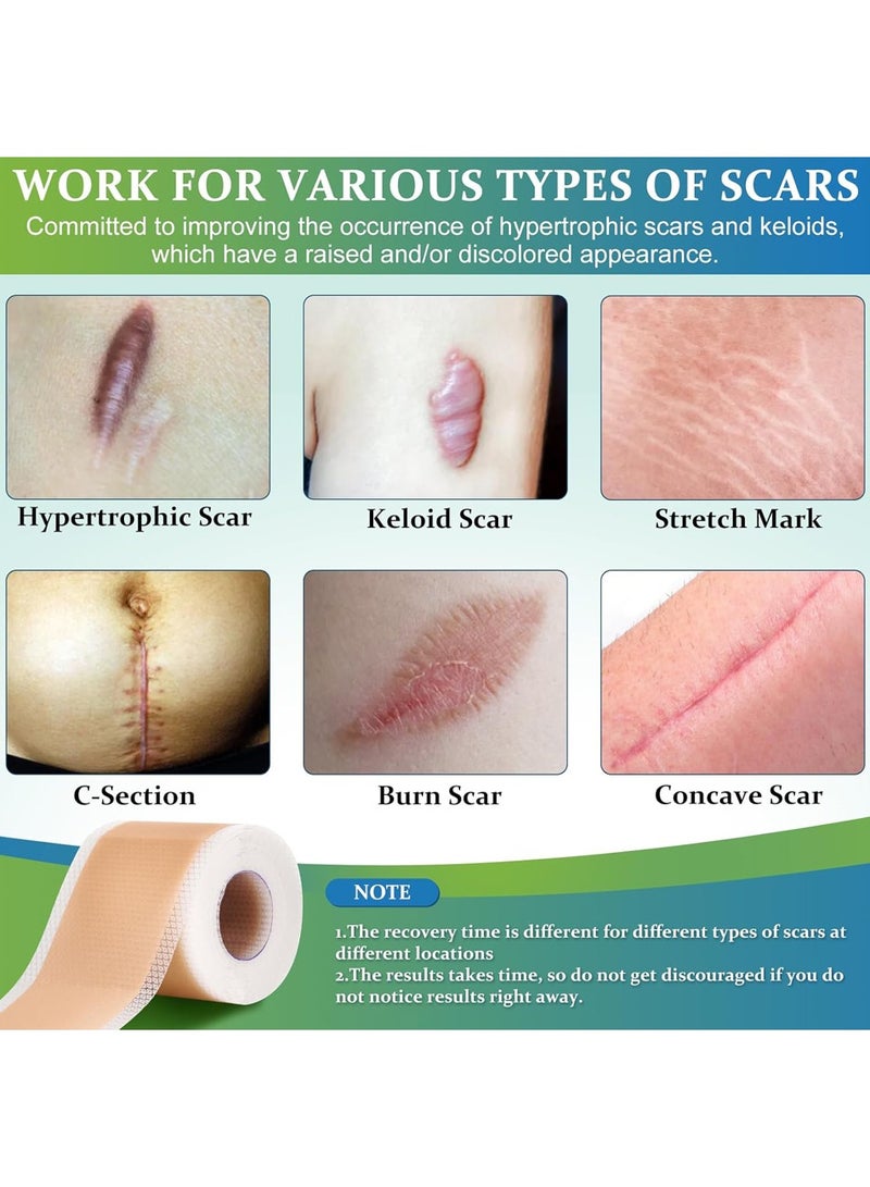 Generic Silicone Scar Sheets, Medical Grade Silicone Scar Tape, Reusable Removal Improve Strips for Surgical C-Section, Keloid, Tummy Tuck, Burn, Acne, Surgery  - Image 4