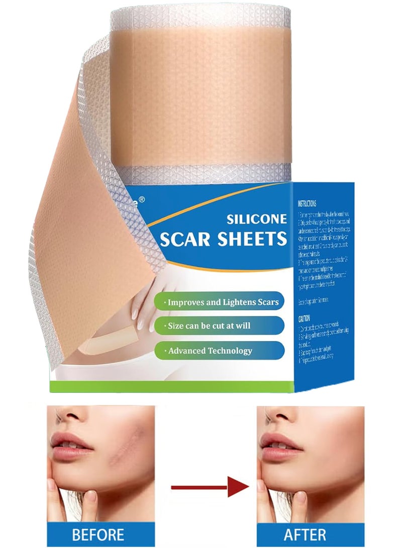 Generic Silicone Scar Sheets, Medical Grade Silicone Scar Tape, Reusable Removal Improve Strips for Surgical C-Section, Keloid, Tummy Tuck, Burn, Acne, Surgery  - Image 1