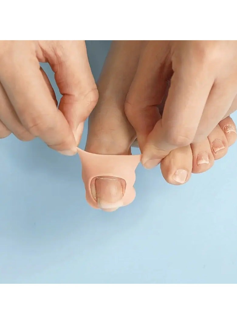Ucanbe 2pcs Comfortable Silicone Ingrown Toenail Protectors - Durable, Odorless Foot Care Tool for Pain Relief & Nail Health  - Image 1