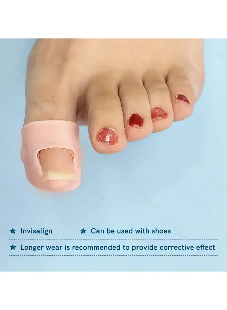 Ucanbe 2pcs Comfortable Silicone Ingrown Toenail Protectors - Durable, Odorless Foot Care Tool for Pain Relief & Nail Health  - Image 2