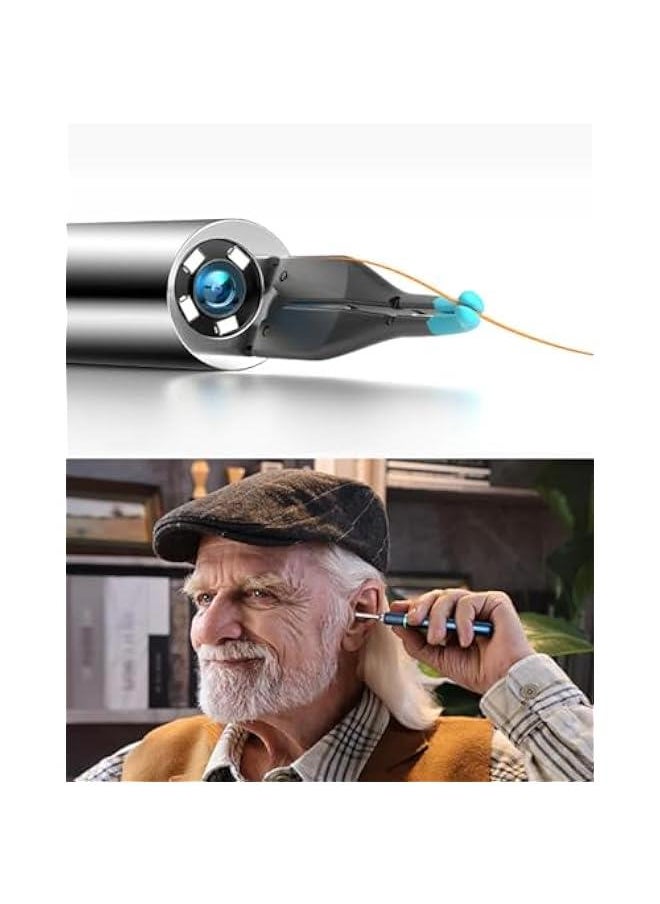 Bebird - Note 5 Pro Ear Canal Cleaner: FHD Camera with Omnidirectional Tweezers, IoT-Enabled Otoscope Support Remote Videos, Magnetic On/Off Cap, Ear Hygiene StorageBase - Image 1