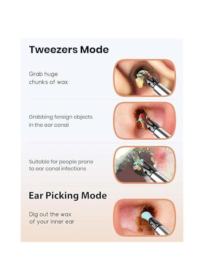 Bebird - Note 5 Pro Ear Canal Cleaner: FHD Camera with Omnidirectional Tweezers, IoT-Enabled Otoscope Support Remote Videos, Magnetic On/Off Cap, Ear Hygiene StorageBase - Image 1
