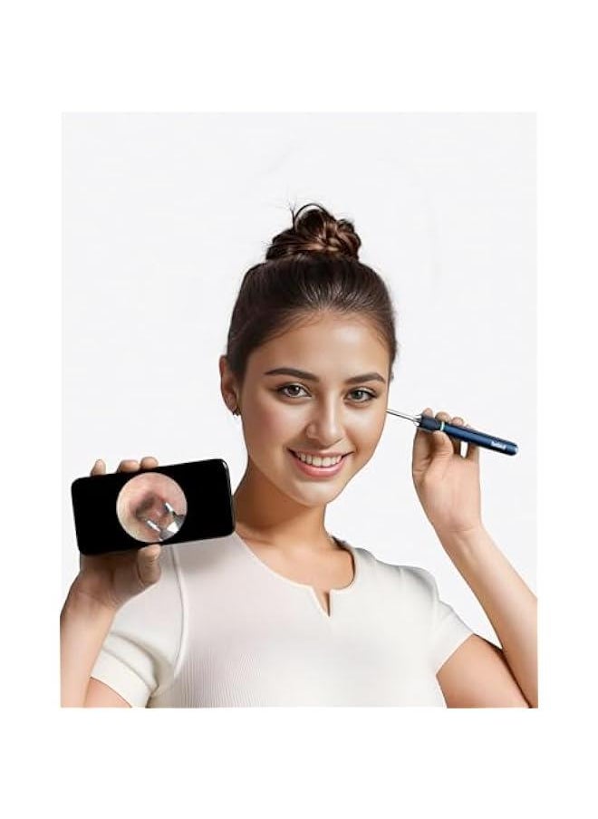 Bebird - Note 5 Pro Ear Canal Cleaner: FHD Camera with Omnidirectional Tweezers, IoT-Enabled Otoscope Support Remote Videos, Magnetic On/Off Cap, Ear Hygiene StorageBase - Image 1