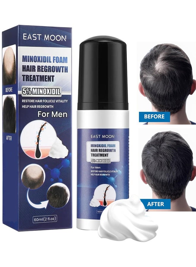 إيست مون رغوة مينوكسيديل 5٪ لنمو الشعر للرجال، لمحاربة تساقط الشعر، وترقق الشعر، وتراجع خط الشعر، يعزز لحية وشعر أكثر كثافة، يساعد على منع الترقق، ويكثف الشعر ليصبح أكثر امتلاءً، غير دهنية - 60 مل - Image 1