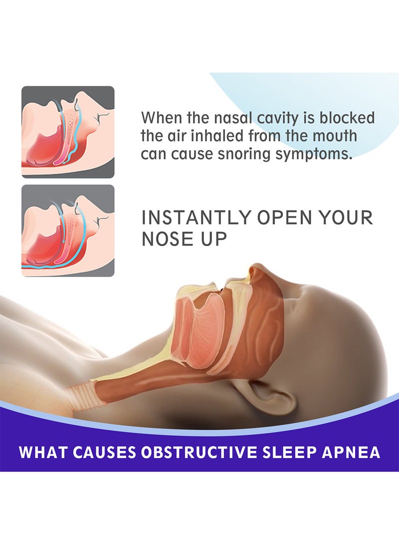 Sefudun Nasal Strips to Breathe Easy and Sleep Easy, Anti-Snoring Nose Strips to Relieve Nasal Congestion Caused by Colds and Allergies (30 Pcs, Beige) - Image 2