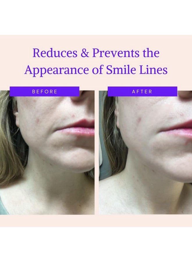 BLUMBODY Face Wrinkle Patches Anti Wrinkle Facial Patches To Smooth Smile Lines Nonsilicone Face Patches Wrinkles Tape For Fine Wrinkles Between Eyes & Face For Overnight Wrinkle Use - Image 2