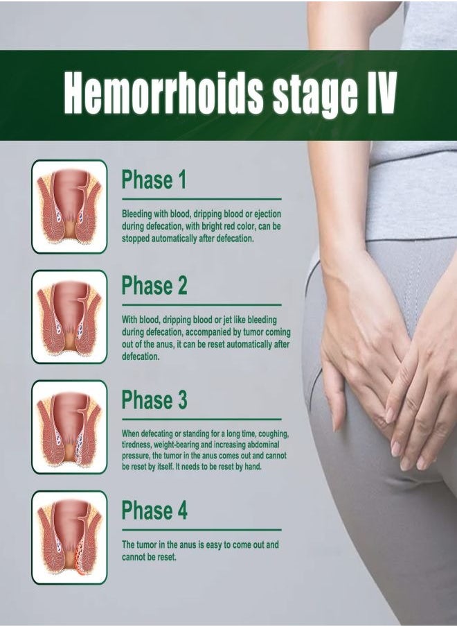 SOUTH MOON Hemorrhoid Treatment All Natural Fast Relief Herbal Hemorrhoid Cream Healing Formula for Burning Itching Pain Bleeding and Swelling - 1Pcs  - Image 5