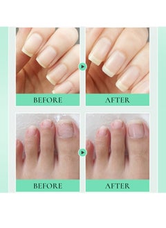 AuQuest Cuticle Care Oil, Deep Acting Cuticle Oil, Nail Hardener, Nourishes, Moisturizes, Moisturizes Dry And Cracked Nails, Nourishes And Softens Cuticles-10ml  - Image 4