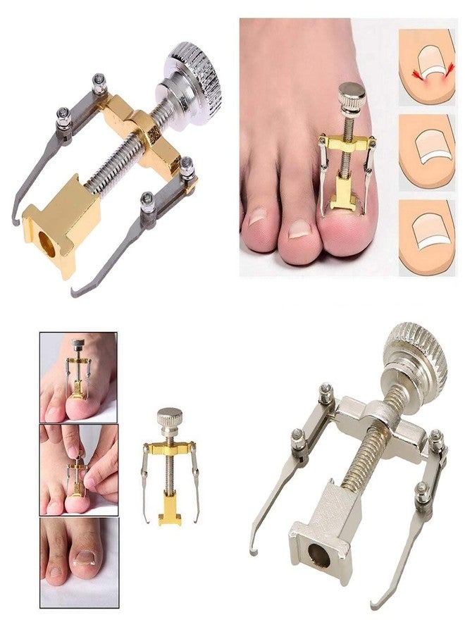 jeoga أدوات تصحيح أظافر القدم المنغرسة من jeoga® - عبوة من 1 - Image 2