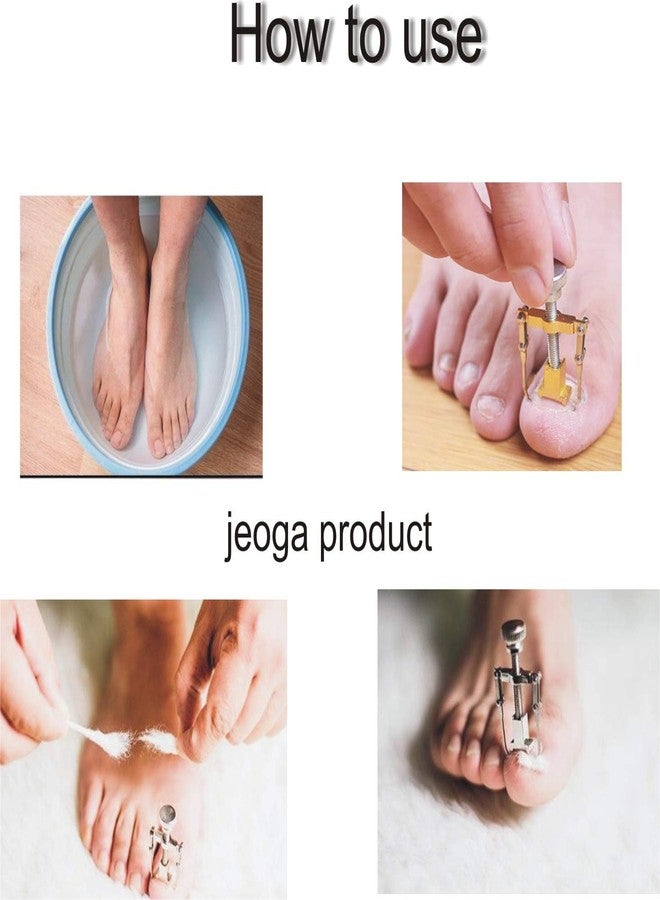 jeoga أدوات تصحيح أظافر القدم المنغرسة من jeoga® - عبوة من 1 - Image 3