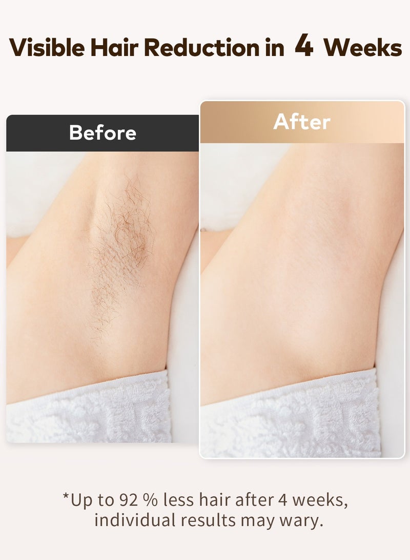 چويي جهاز إزالة الشعر بالليزر، جهاز إزالة الشعر الدائم في المنزل بـ 9 مستويات مطورة 999900 ومضة لإزالة شعر الوجه والإبطين والذراعين والساقين - Image 3