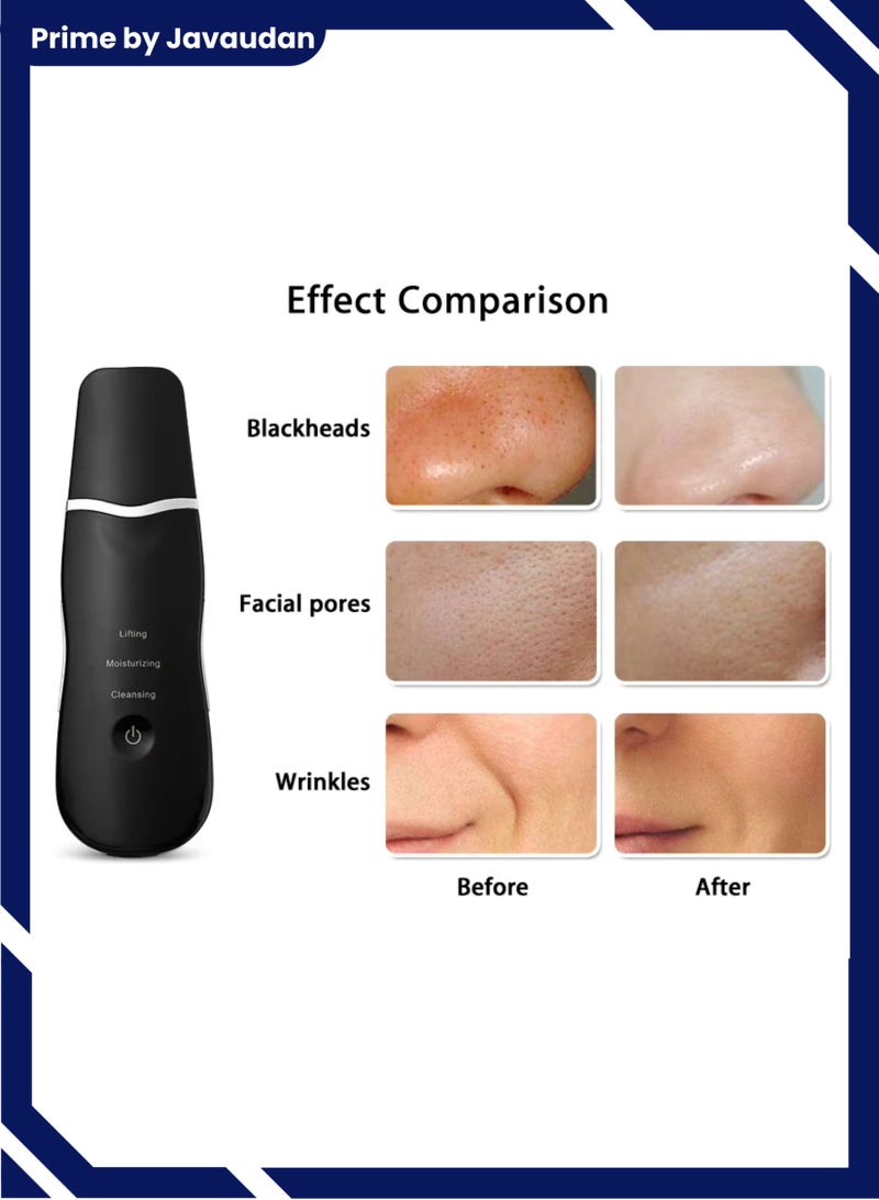 جهاز تنظيف البشرة الفاخر لإزالة الرؤوس السوداء بالموجات فوق الصوتية، جهاز تنظيف عميق للوجه ومزيل للرؤوس البيضاء، مستخرج البثور، منظف الوجه، مجرفة تقشير قابلة لإعادة الشحن - Image 2