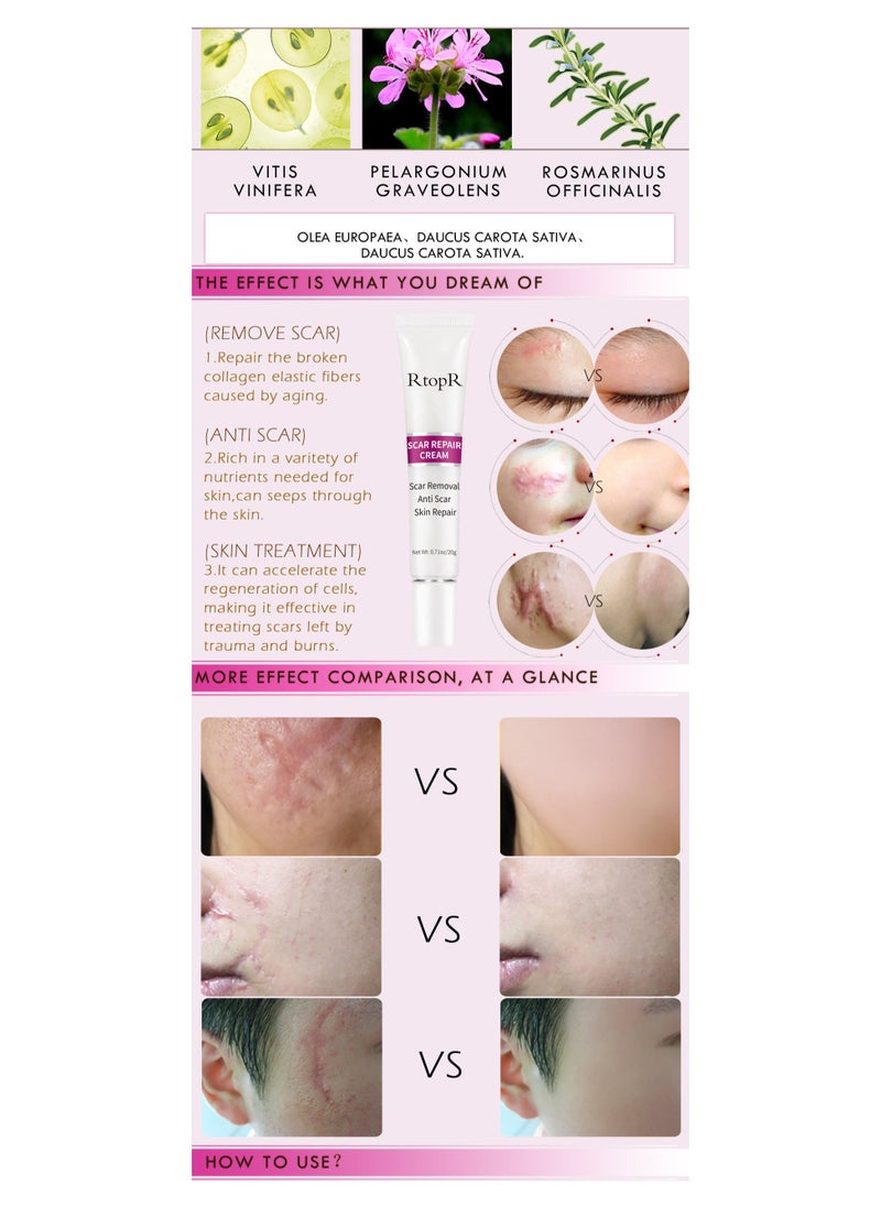 RtopR Scar Repair Cream Stretch Mark Removal Gel  - Image 2