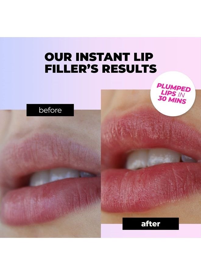 Instant Lip Filler for Plumped Lips in 30 Mins Vegan Collagen, Multi-Molecular Hyaluronic Acid & 400 Dissolving Micro-Dart Technology for Instant & Long-Lasting Results