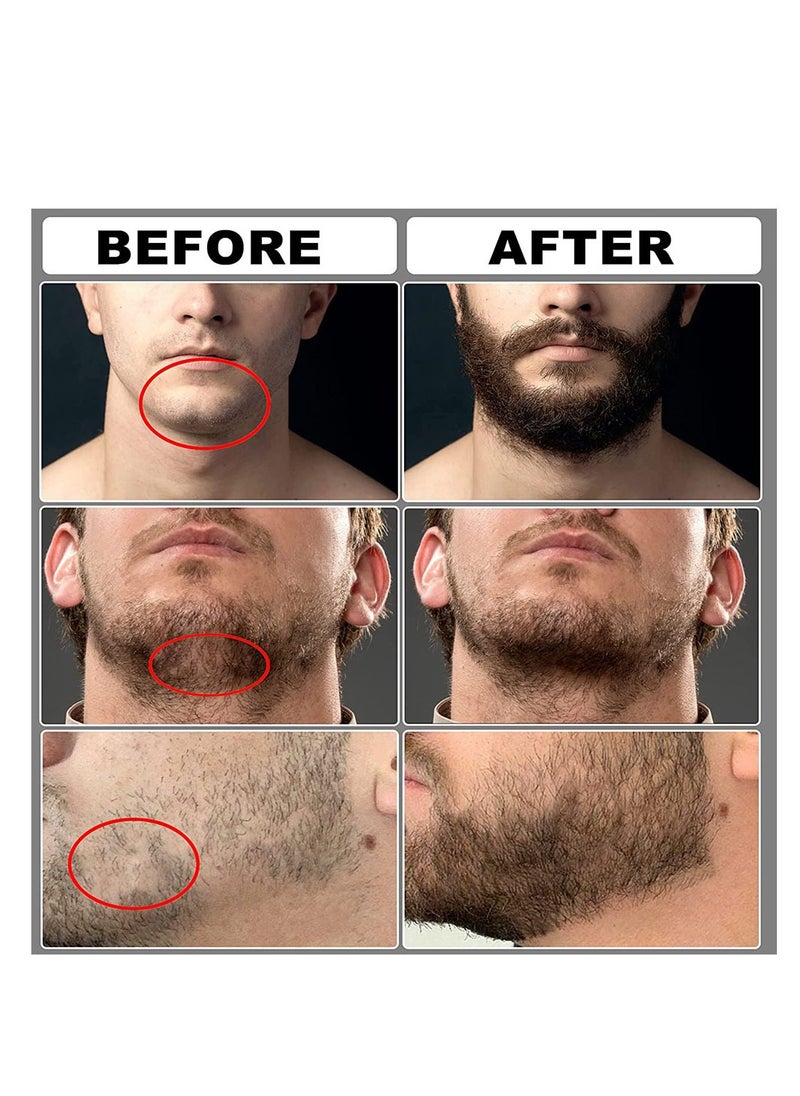 NNEWVANTE - Beard Growth Kit,Beard Kit for Men,Beard Growth Oil (2oz), Beard Balm and Comb,Stimulate Beard and Hair Growth-Gifts for Men Dad Him Boyfriend Husband Brother - Image 1