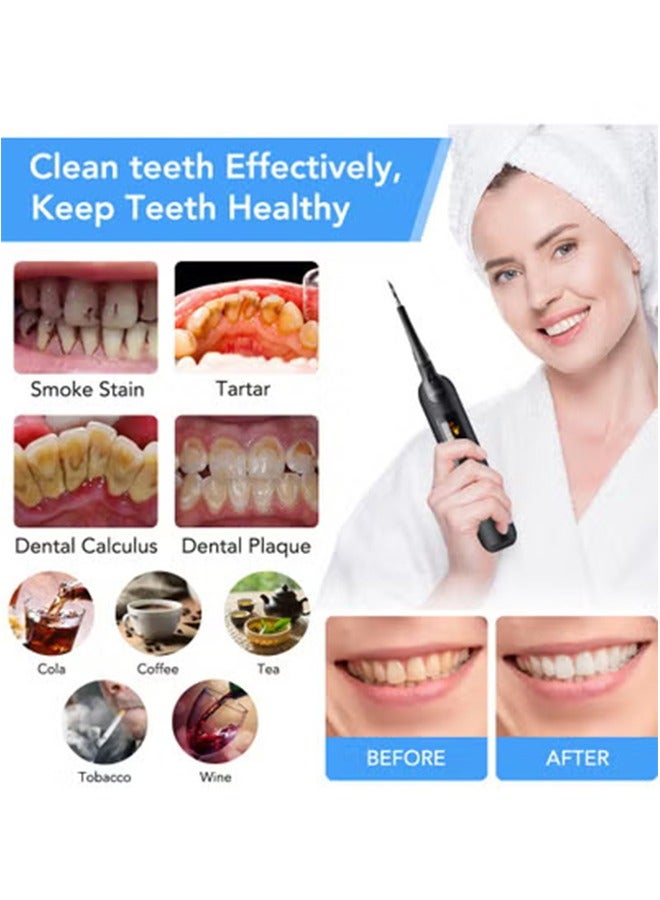 عام مجموعة جهاز تنظيف الأسنان المحمول بالماء، مزيل البلاك الكهربائي للأسنان، مجموعة أدوات تنظيف الأسنان بتقنية LED بالموجات فوق الصوتية، آمنة لكل من الأطفال البالغين - Image 3