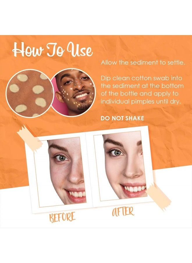 Bye Bye Blemish Dark Spot Lotion Vitamin C | Assists with Drying Blemishes And Brightening Skin | Fast Acting Solution | 1 Fl. Oz. - Image 4