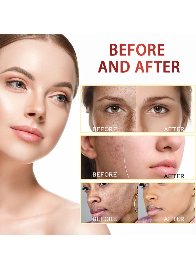 OUHOE - Spot Fading Essence Whitening Skin Fading Dark Spots and Acne Hydrating Moisturizing and Anti Aging Essence - Image 1