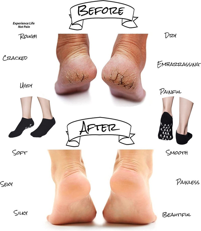 Pnrskter Gel Spa Moisturizing Gel Socks for Repairing and Softening Dry Cracked Feet Skins (Men Size(Black)) - Image 4