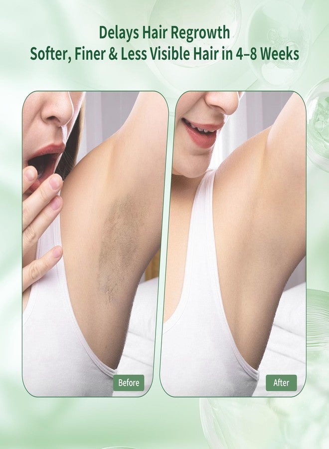 ShineMore Cyperus Rotundus Oil for Hair Removal: Hair Growth Inhibitor Organic Cyperus Oil for Reducing Body Hair Growth, Deep Nourishing Smoothing Skin Non-greasy Gent Formula for All Skin Types 60 ML - Image 2
