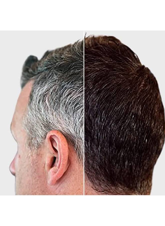 verseo - Grayban Hairspray Color Restorer For Gray Hair Nondye Color Restoring Spray Natural Protein Pigments Restore The Natural Color Of Your Hair Works With All Hair Colors And Types - Image 1