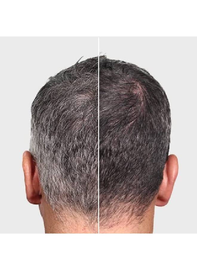 verseo - Grayban Hairspray Color Restorer For Gray Hair Nondye Color Restoring Spray Natural Protein Pigments Restore The Natural Color Of Your Hair Works With All Hair Colors And Types - Image 1