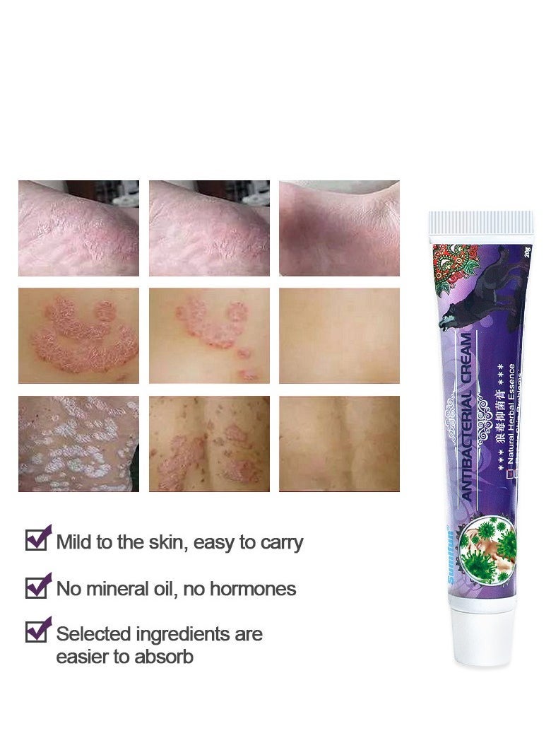 Sumifun عبوة من 2 كريم مضاد للبكتيريا - للاستخدام الموضعي على الجلد لعلاج التهاب الجلد، قشرة الرأس، قدم الرياضي، حكة الفخذ، الصدفية، الشرى، الإكزيما - فعال ضد العدوى الفطرية والبكتيرية - مرطب - Image 2