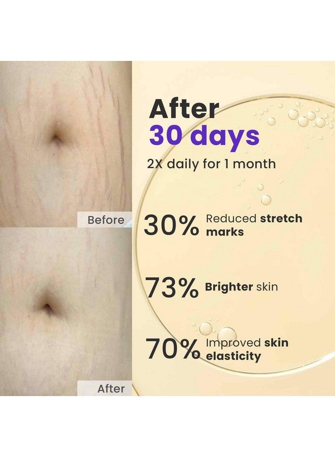 Saffr'n Anti Stretch Marks Oil with Saffron extract to Prevent Stretch Marks | 30 ml - Image 3